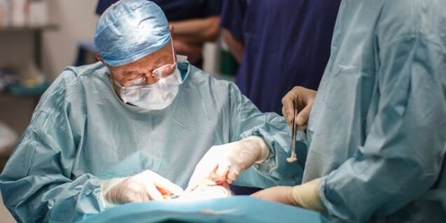 Chirurgie pour enlever les varices.